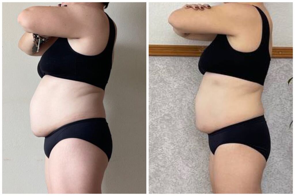 Before and after debloating - reduced abdominal bloating at Love Your Body Studios