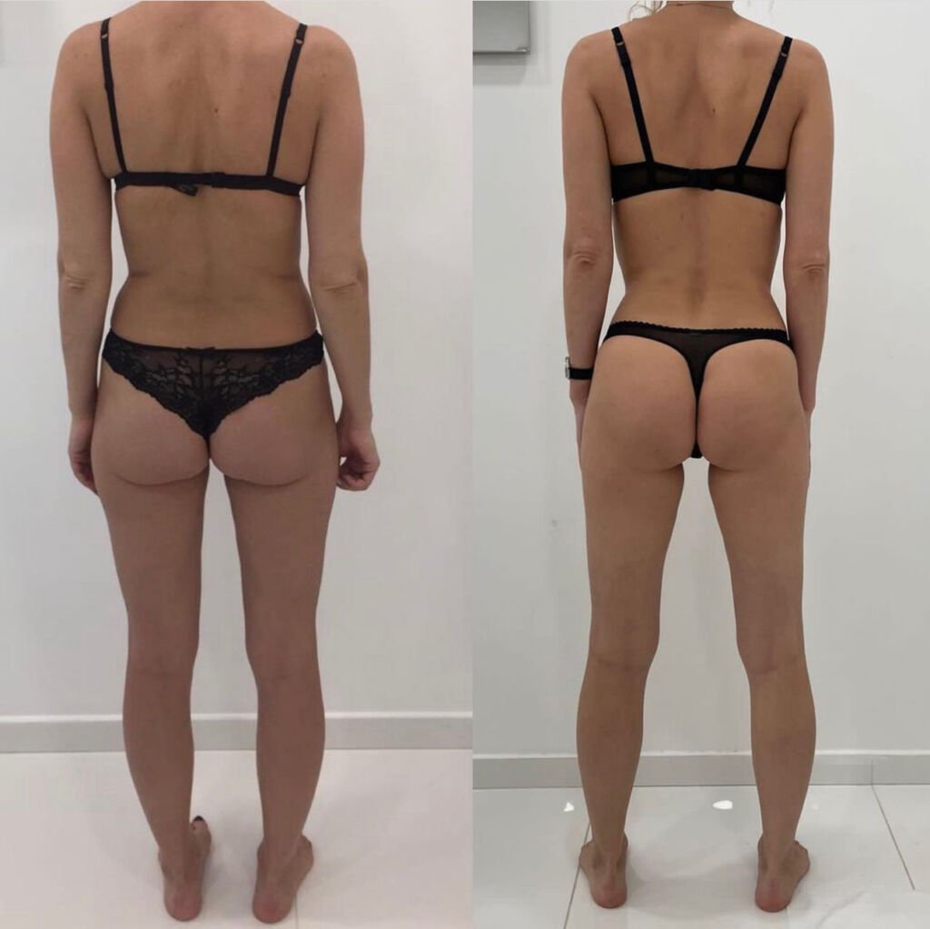 Before and after body sculpting - toned waist and glutes at Love Your Body Studios