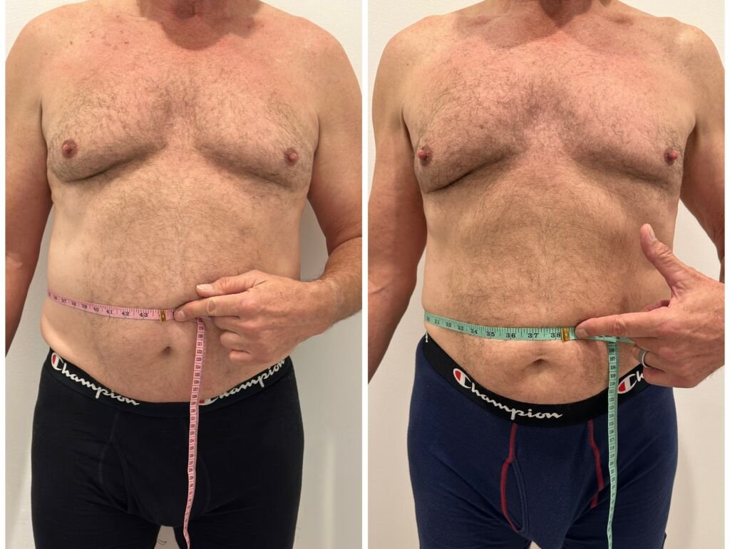 Before and after slimming results - waist measurement reduction at Love Your Body Studios