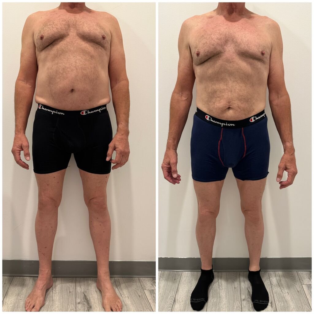 Before and after slimming - male client, full body at Love Your Body Studios