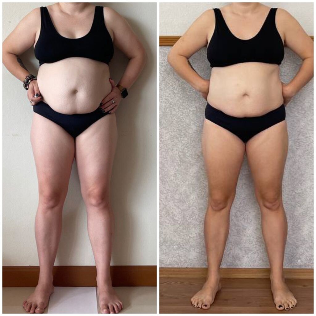 Before and after slimming - full body at Love Your Body Studios